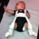 Подвывих тазобедренного сустава у детей лечение Вправление тазобедренного сустава у ребенка
